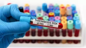 Ilustrační obrázek