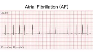 Ilustrační obrázek