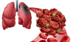 Ilustrační obrázek