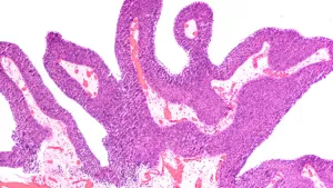 Ilustrační obrázek