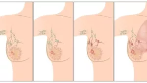 Ilustrační obrázek