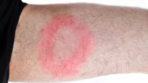 Ilustrační obrázek