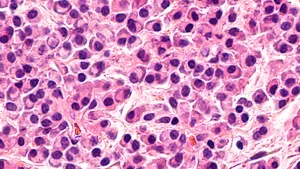 Ilustrační obrázek