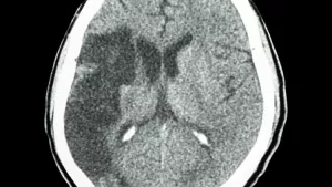 Ilustrační obrázek