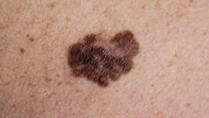 Ilustrační obrázek