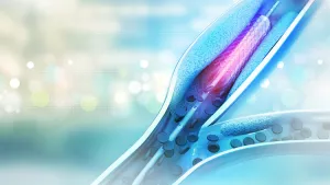 Ilustrační obrázek