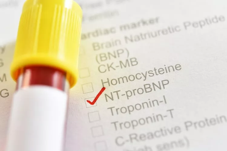 Ilustrační obrázek