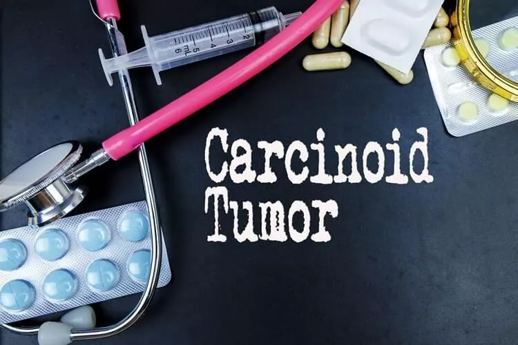 Ilustrační obrázek