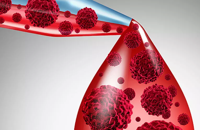 Ilustrační obrázek