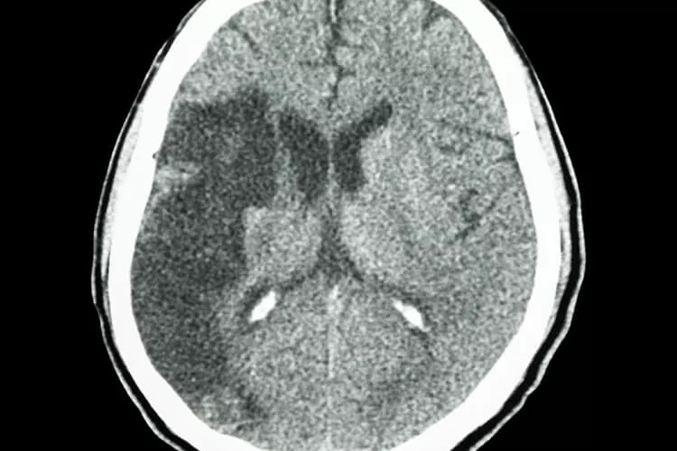 Ilustrační obrázek