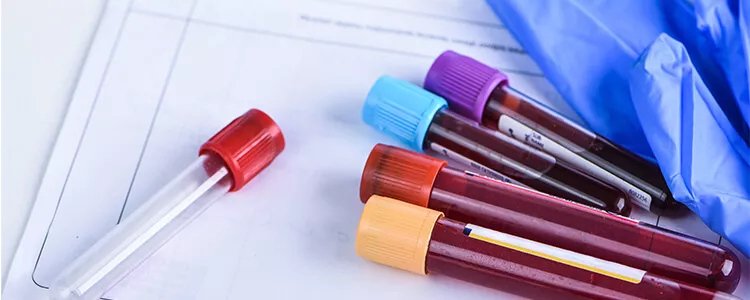 Ilustrační obrázek