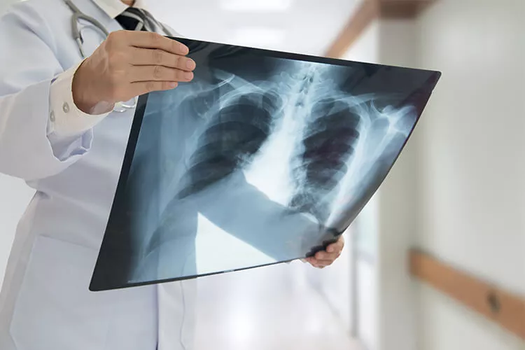 Ilustrační obrázek