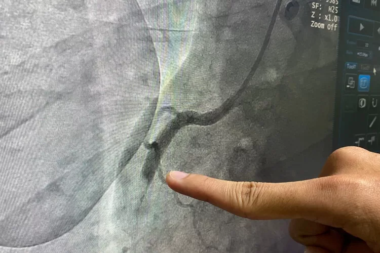 Ilustrační obrázek